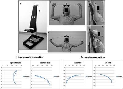 Functional and Brain Activation Changes Following Specialized Upper-Limb Exercise in Parkinson’s Disease